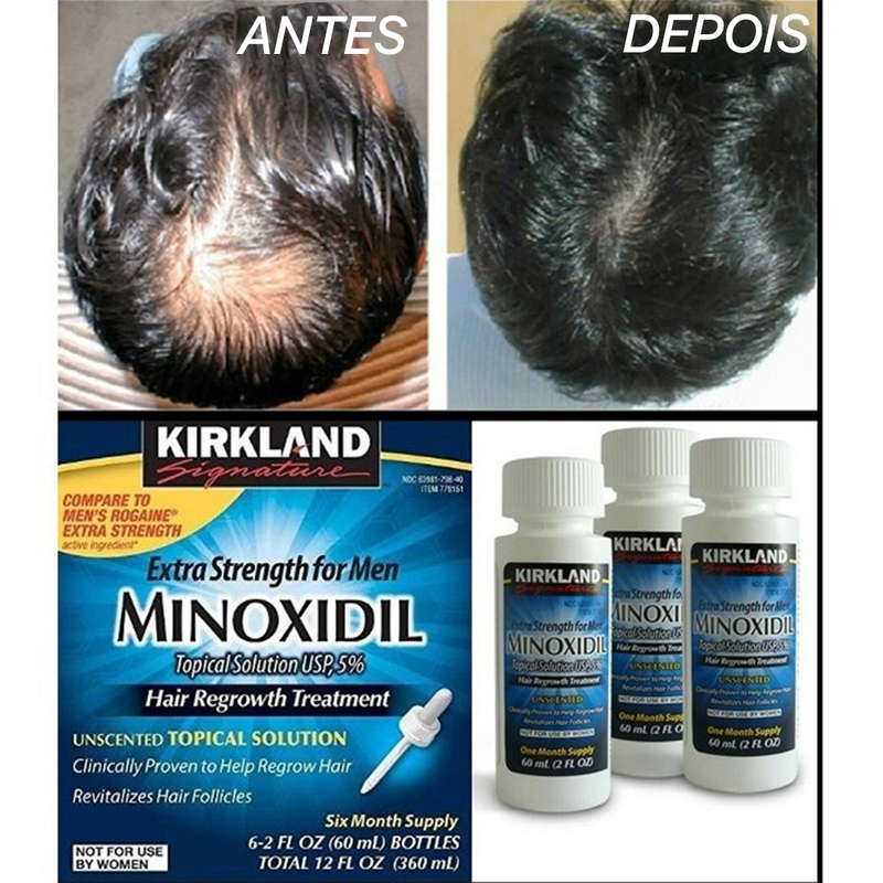 Minoxidil Kitkland Crescimento Cabelo e barba 100%