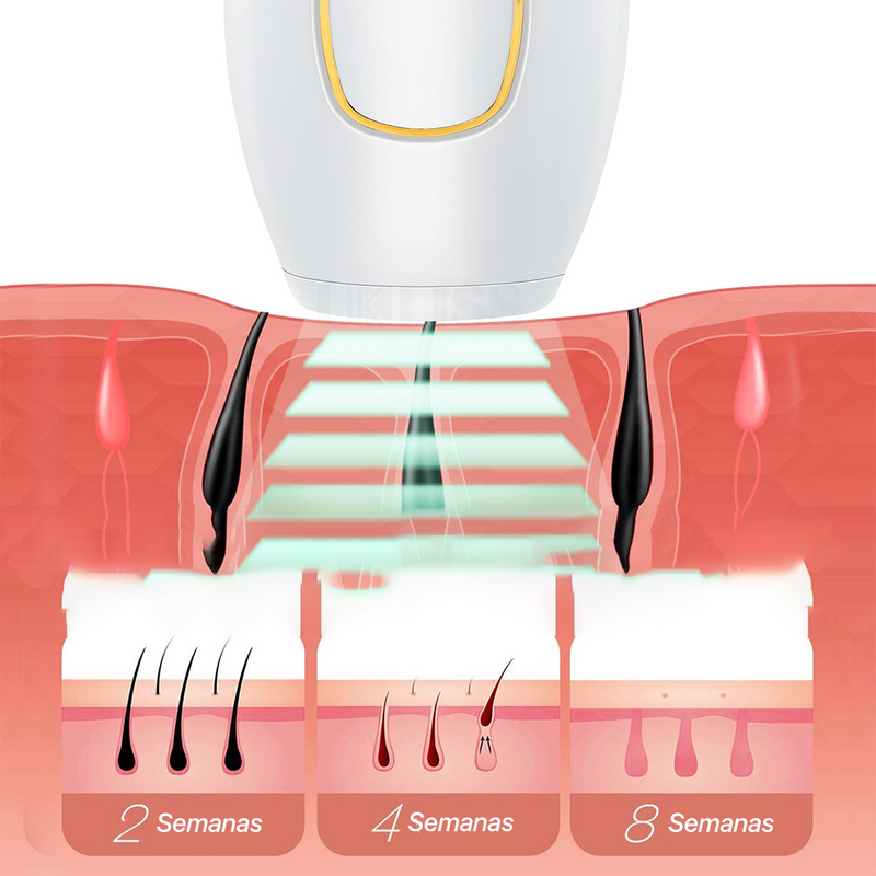 Depilador a Laser portátil Profissional IPL-Definitivo