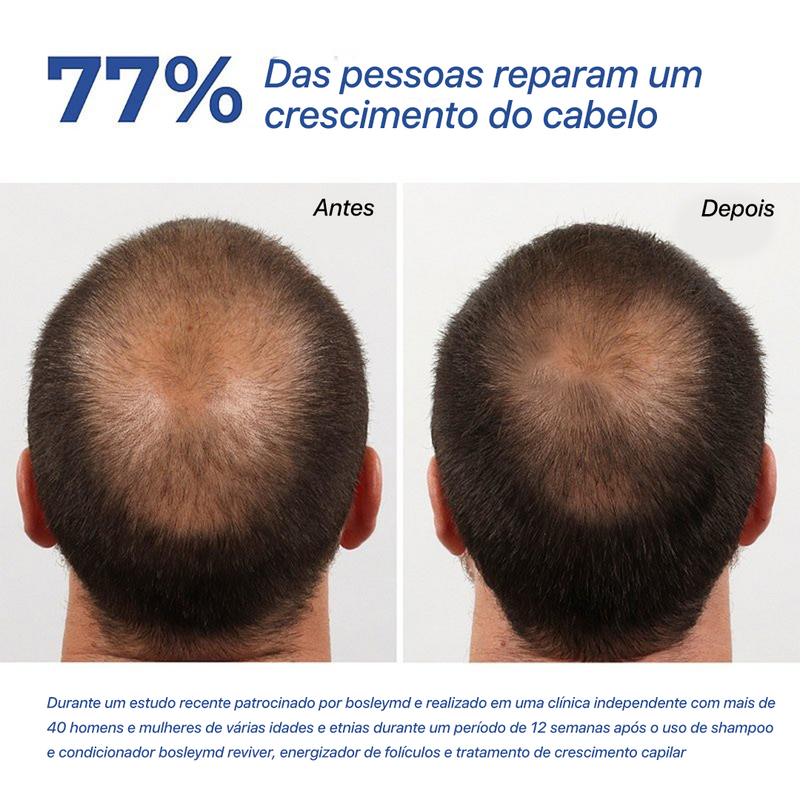 Minoxidil Kitkland Crescimento Cabelo e barba 100%