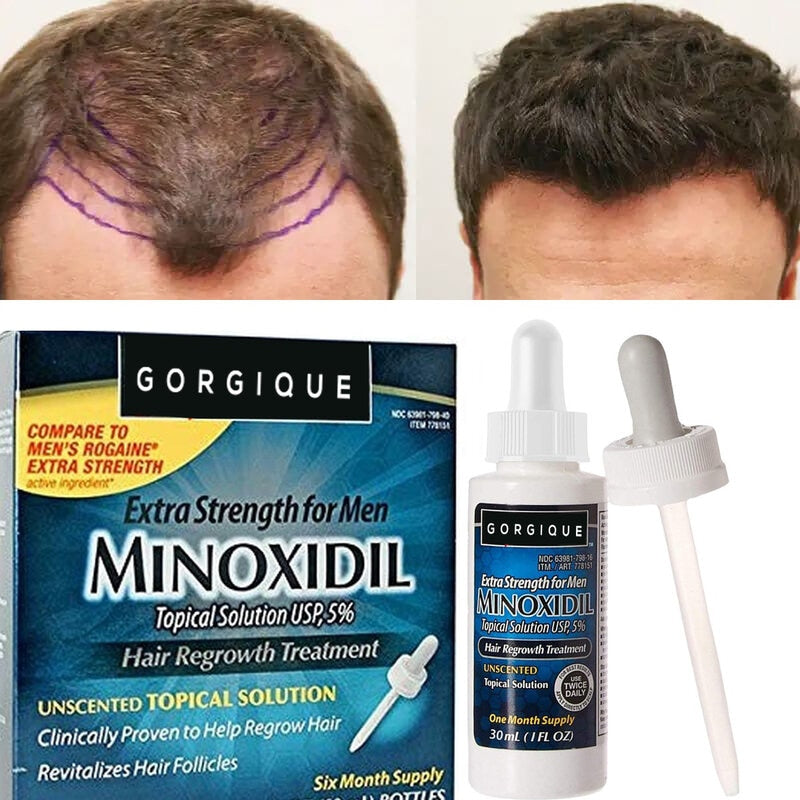 Minoxidil Kitkland Crescimento Cabelo e barba 100%