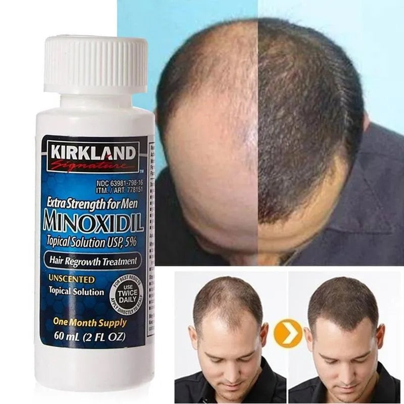 Minoxidil Kitkland Crescimento Cabelo e barba 100%